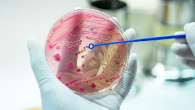 antimicrobial resistance